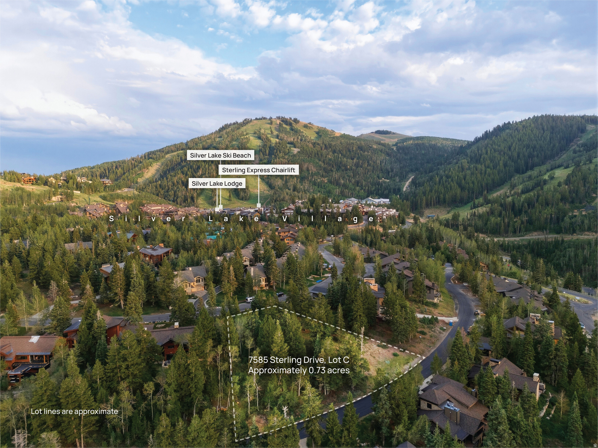 7585 STERLING DR, Park City, UT 84060 — photo 1